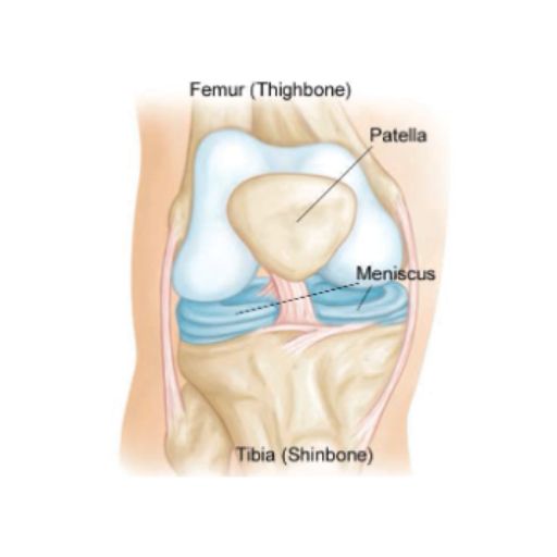 Artroscopia de rodilla